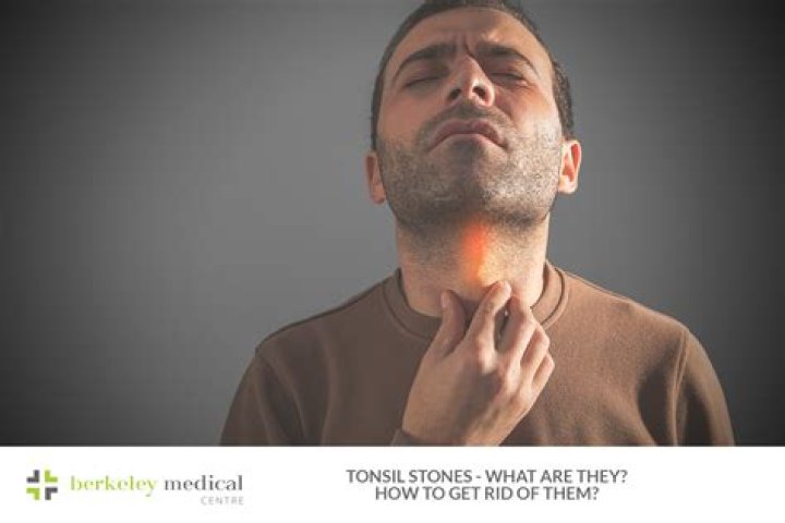 Can 6 year olds get tonsil stones?