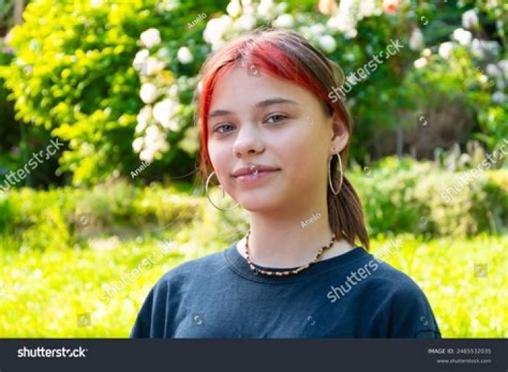 Can a 12 year old lose hair?