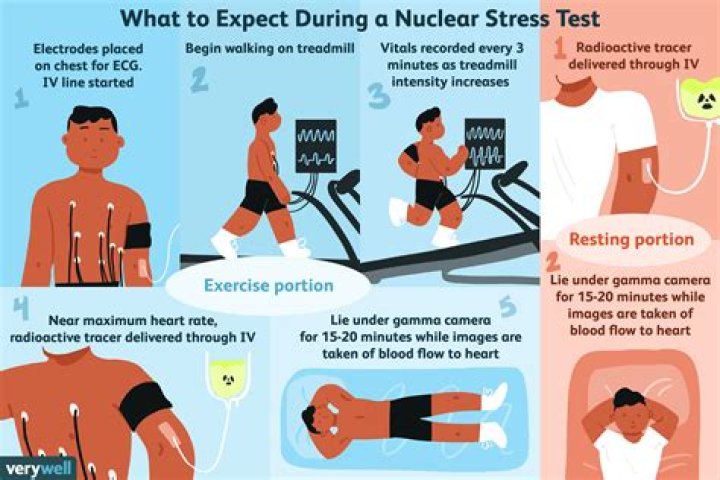 Can a stress test show blockage?