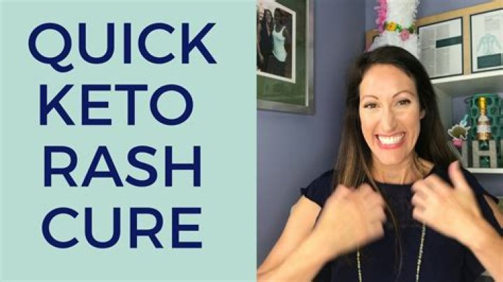 How do I get rid of keto rash on my face?