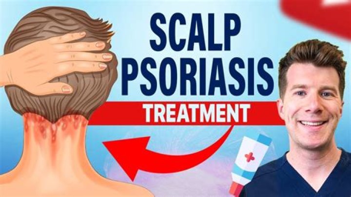 How do you get rid of scalp wounds?