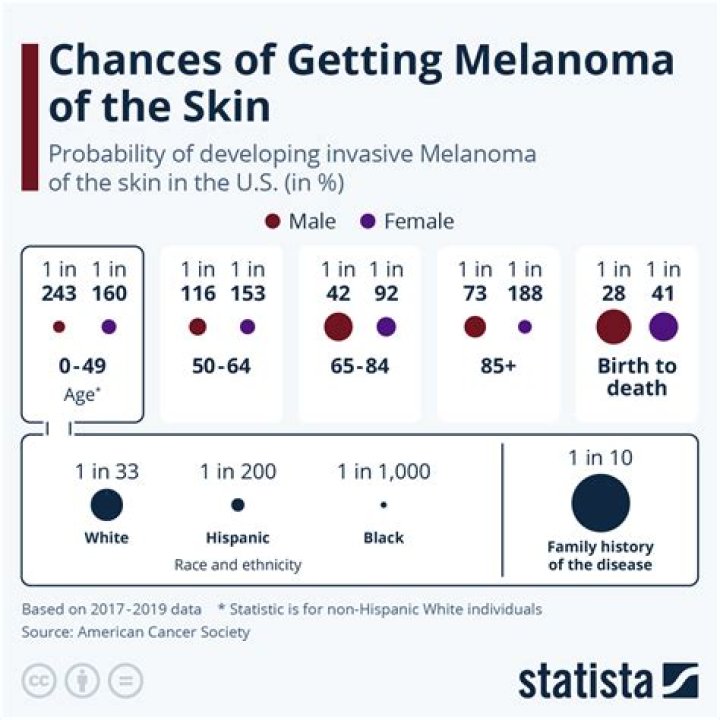 What are characteristics that make it more likely to get melanoma?
