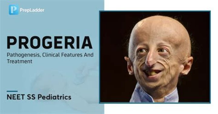 What are the current treatments for progeria?