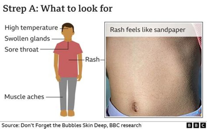 What does a strep rash look like in adults?