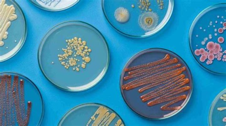 What is the dish in parasite?