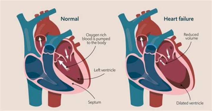 What is the mechanism of heart failure?