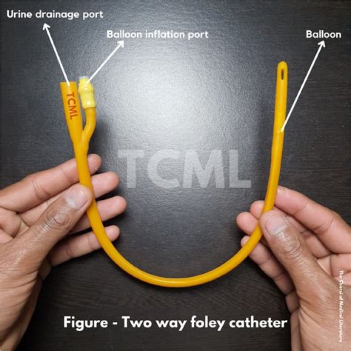 What type of catheter is a Foley?
