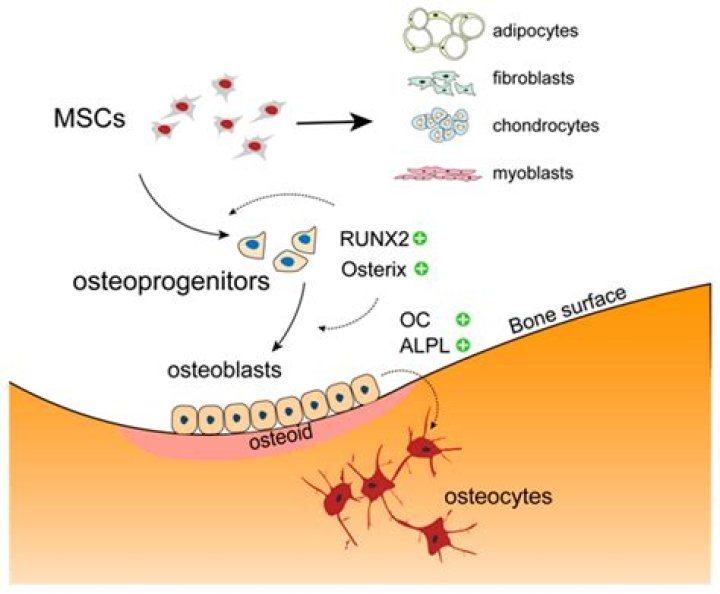 What will response to aspirin osteoid osteoma?